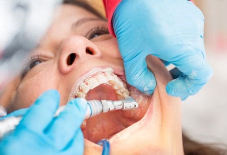 معاینات دوره ای و پیشگیرانه دندانپزشکی