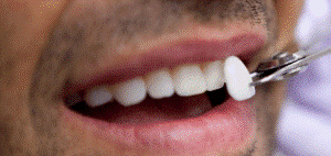 مقایسه دندانپزشکی زیبایی و درمان ارتودنسی