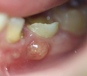 موارد اورژانسی دندانپزشکی