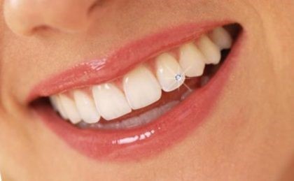خطرات پیرسینگ دهان و دندان