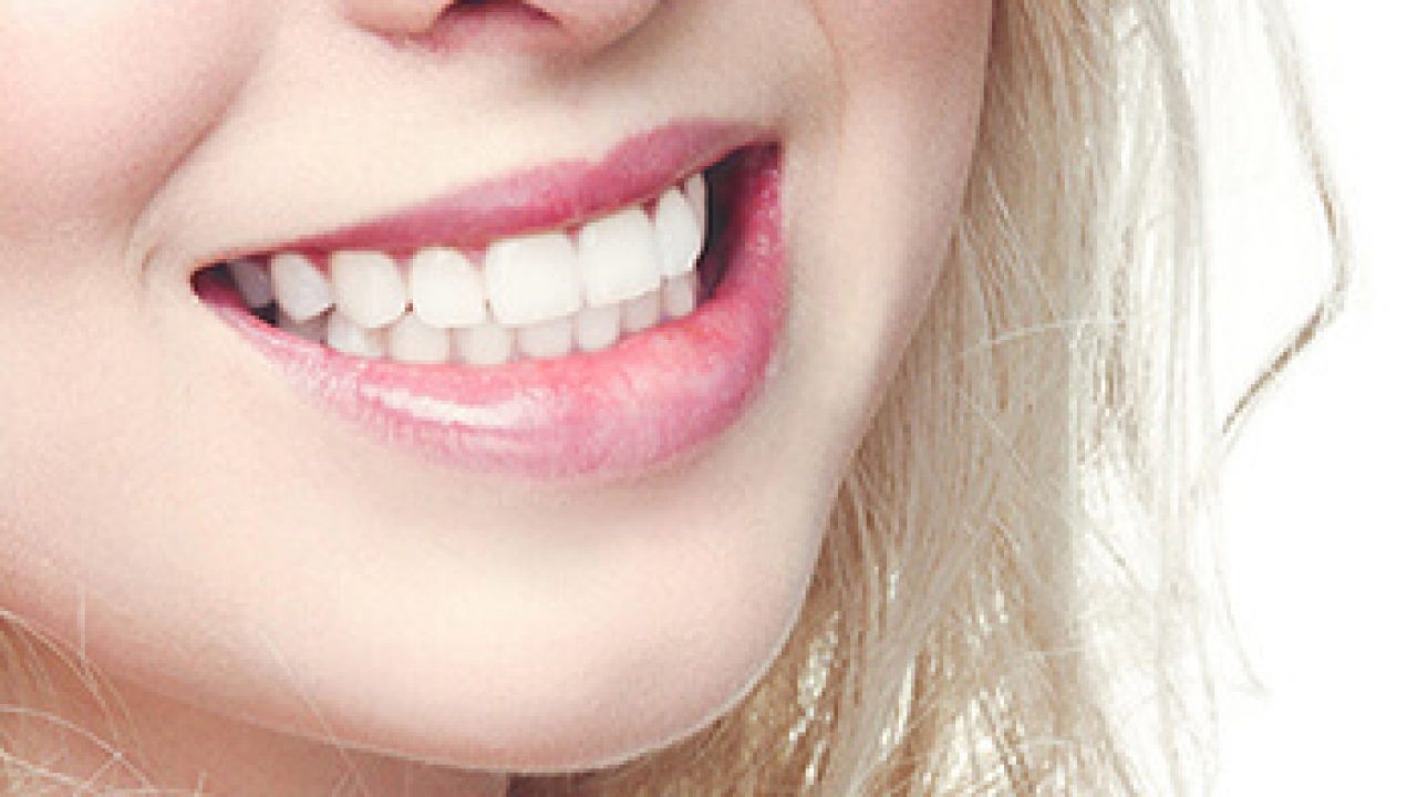سفید کردن دائمی دندان