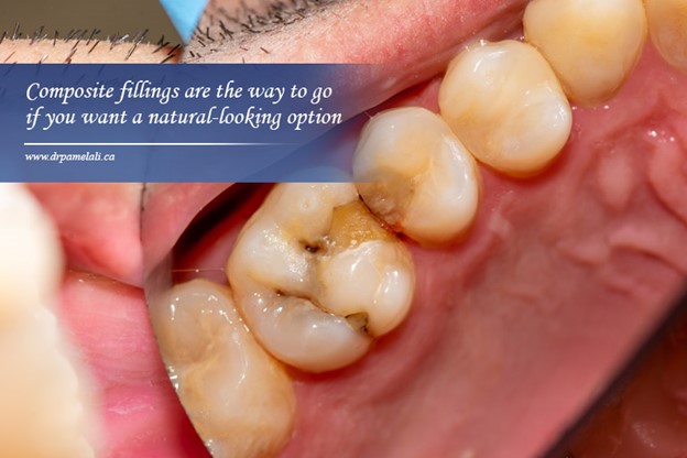 علل دندان درد هنگام گاز زدن