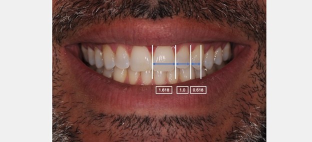 طول ایده آل دندان