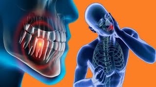 درد ریشه در معرض محیط دهان چه زمانی رخ می دهد؟