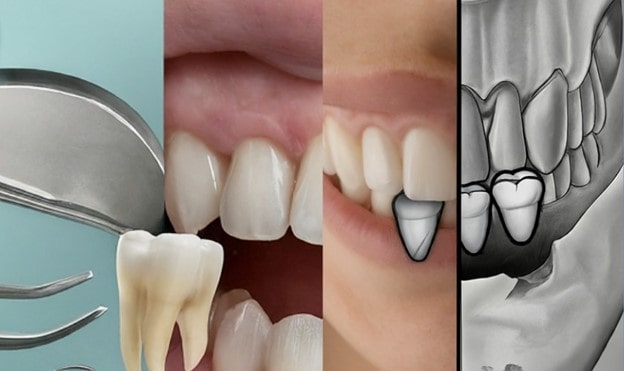 دندان عقل چگونه می تواند روی ظاهر فک تأثیر منفی بگذارد؟